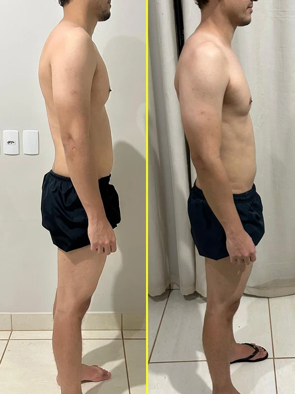 11 antes e depois copiar