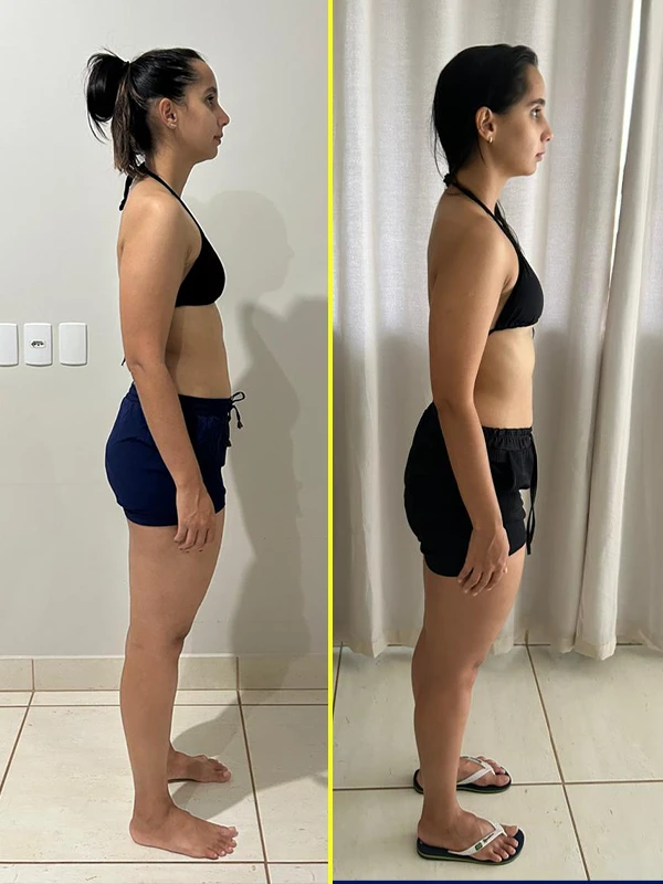 8 antes e depois copiar