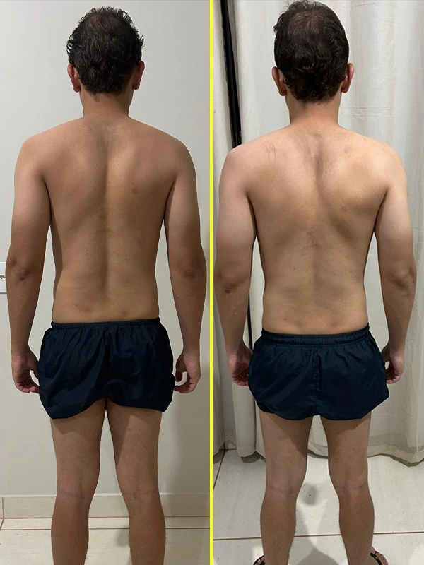 9 antes e depois copiar